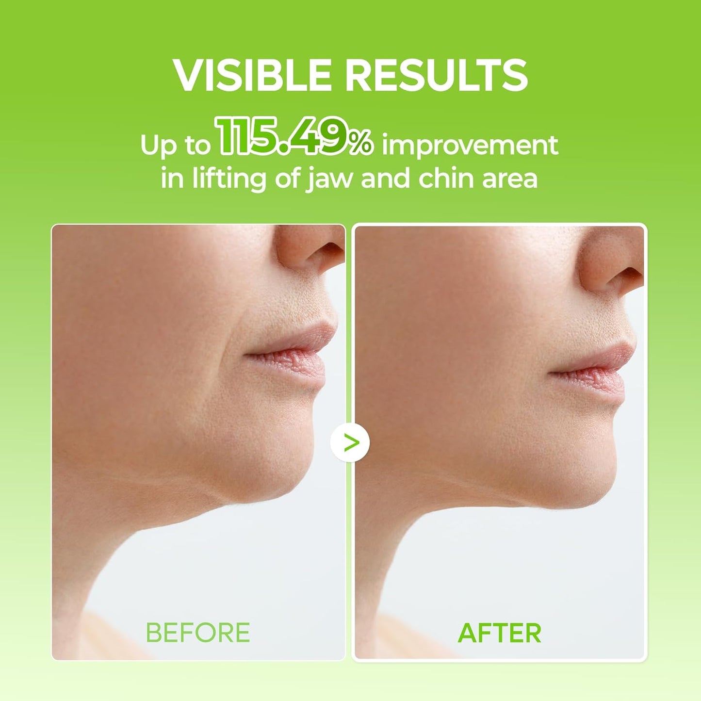 V-Lift Face Shaping Band