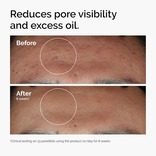 Radiant Skin Smoothing Serum