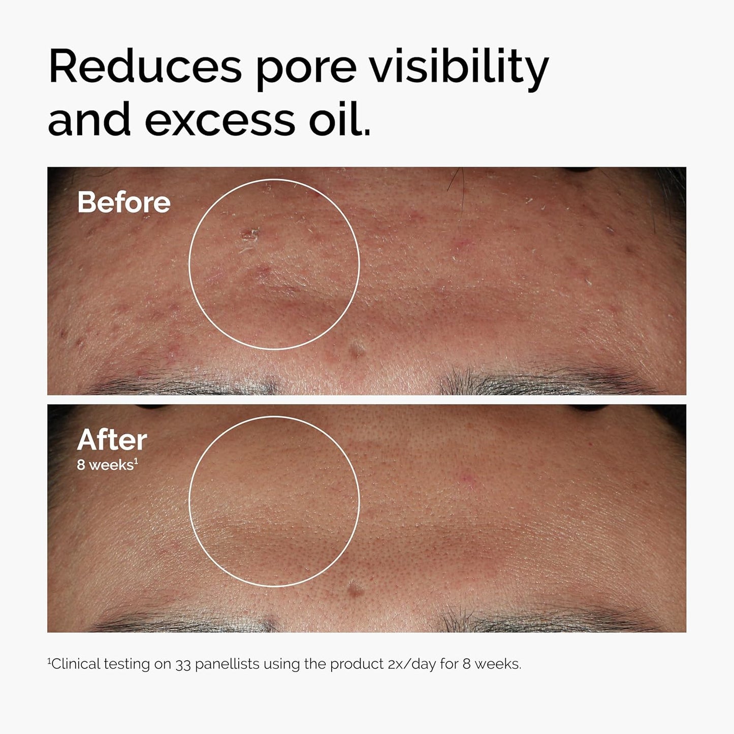 Radiant Skin Smoothing Serum